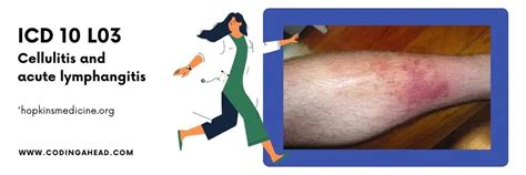 Cellulitis left lower leg icd 10 - The ICD code L03 is used to code Cellulitis. Cellulitis is a bacterial infection involving the inner layers of the skin. It specifically affects the dermis and subcutaneous fat. Signs and …